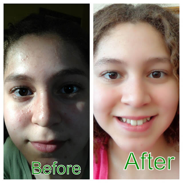 Miliany Bonet's face is shown before and after adopting a raw food diet