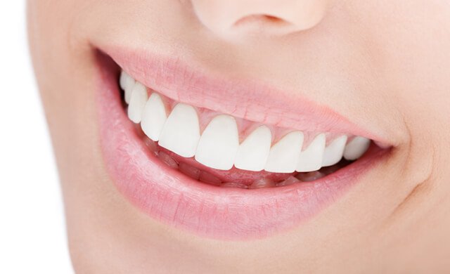 Closeup of a woman's smile with white healthy teeth