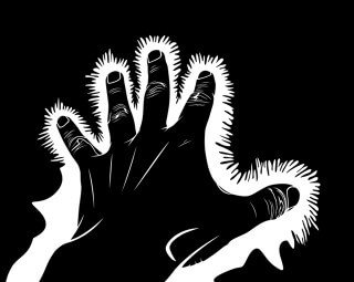Electric shock in the hand