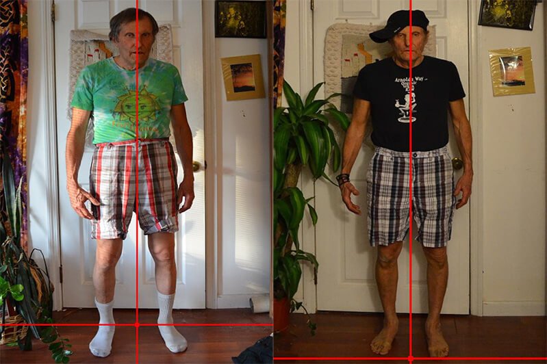 Arnold Kauffman photo comparison showing his progress with his Posture Exercises Method practice