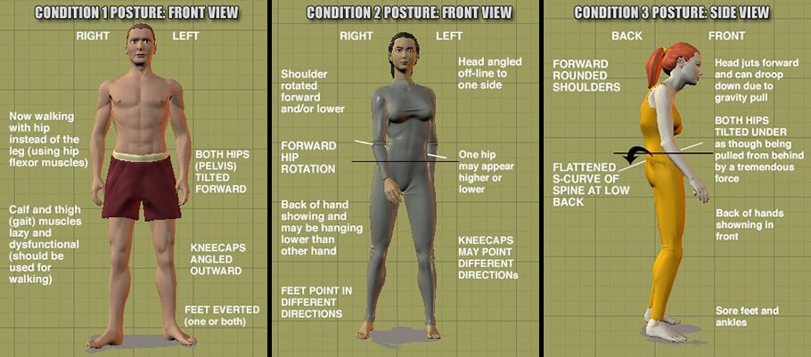 Condition postures in the Egoscue Method